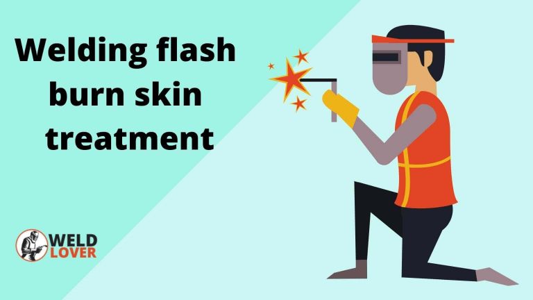 Welding flash burn skin treatment